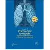 Manuel de ventilation appliquée en anesthésie réanimation et médecine ...