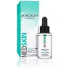 Postquam - Med Skin | Peeling du Visage pour une Peau Douce et Veloutée - 30 ml