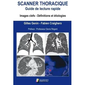 Comparateur de prix : Sauramps Medical Scanner thoracique : Guide de lecture rapide: Images clefs, définitions et étiologies