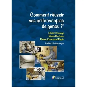 Sauramps Medical Comment Réussir Ses Arthroscopies De Genou ? pas cher