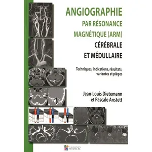Sauramps Medical Angiographie Par Résonance Magnétique (Arm) Cérébrale Et Médullaire - Techniques, Indications, Résultats, Variantes Et Pièges pas cher