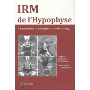 Sauramps Medical IRM de l'hypophyse pas cher