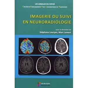 Comparateur de prix : Sauramps Medical Imagerie du suivi en neuroradiologie