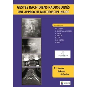 Comparateur de prix : Sauramps Medical Gestes Rachidiens Radioguidés : Une Approche Multidisciplinaire