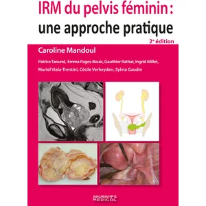 Sauramps Medical IRM du pelvis féminin : une approche pratique pas cher