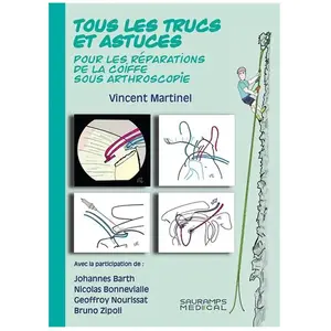 Comparateur de prix : Sauramps Medical Tous les trucs et astuces pour les réparations de la coiffe sous arthroscopie