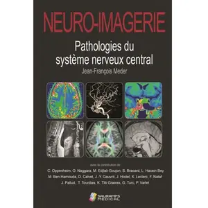 Sauramps Medical Neuro-imagerie: Pathologies du système nerveux central pas cher