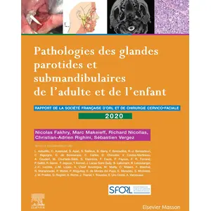 Elsevier Masson Pathologies des glandes parotides et submandibulaires de l'adulte et de l'enfant