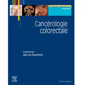 Comparateur de prix : Cancérologie colorectale