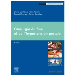 Chirurgie du foie et de l'hypertension portale pas cher