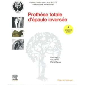 Prothèse totale d'épaule inverséeVendu parrakuten