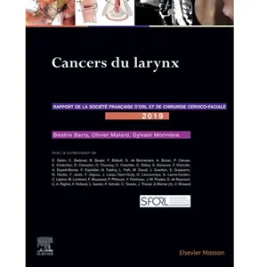 Comparateur de prix : Cancers du larynx