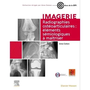 Elsevier Masson Radiographies Ostéoarticulaires - Eléments Sémiologiques À MaitriserVendu paramazon