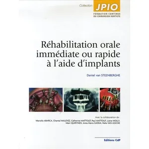 Cdp Réhabilitation orale immédiate ou rapide à l'aide d'implants pas cher