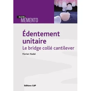 Comparateur de prix : Cdp Edentement unitaire : le bridge collé cantilever