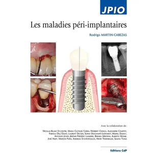 Cdp Les maladies péri-implantaire pas cher
