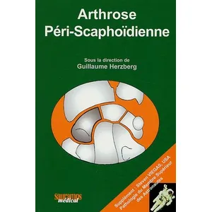 Sauramps Medical Arthrose Péri-Scaphoïdienne pas cher
