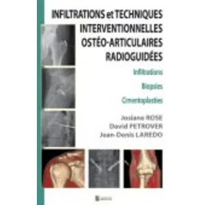 Comparateur de prix : Sauramps Medical Infiltrations Et Techniques Interventionnelles Ostéo-Articulaires Radioguidées - Infiltrations, Biopsies, Cimentoplasties