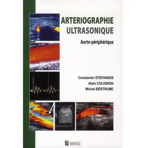 Comparateur de prix : Arteriographie ultrasonique