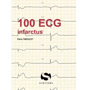 S-Editions 100 Ecg Infractus pas cher
