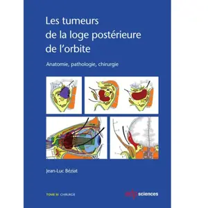 Les tumeurs de la loge postérieure de l'orbite pas cher
