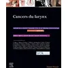 Image de Cancers du larynx: Rapport 2019 de la Société française d'ORL et de chirurgie cervico-faciale