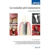 Image de Les Maladies Péri-Implantaire en occasion ou reconditionné