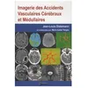 Image de Imagerie Des Accidents Vasculaires CÃ©rÃ©braux Et MÃ©dullaires en occasion ou reconditionné