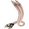Image de Inakustik STAR Stereo RCA (1.50 m, Câbles Cinch), Câble audio