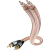 Image de Inakustik Star Cable Audio
