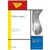 Image de Hallux Valgus