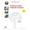 Image de ProthÃ¨se Totale D'Ã©paule InversÃ©e