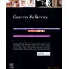 Image de Cancers Du Larynx - Rapport 2019 De La Société Française D'orl Et De Chirurgie Cervico-Faciale