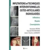 Image de Infiltrations Et Techniques Interventionnelles Ostéo-Articulaires Radioguidées - Infiltrations, Biopsies, Cimentoplasties