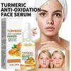Image de Zeer effectieve kurkuma creme gezichts serum voor anti aging, verminderd huidveroudering, vlekken huiduitslag acne met natuurlijke ingredienten