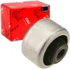Image de TRW JBU709 Silentbloc