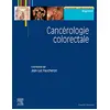 Image de Cancérologie colorectale