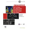 Image de Imagerie de l'orbite, du labyrinthe membraneux et de la base du crâne
