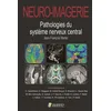 Image de Neuro-imagerie: Pathologies du système nerveux central